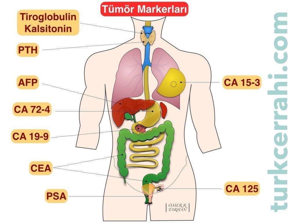 CA 19-9 Nedir? Bilmeniz Gereken 10 Önemli Bilgi