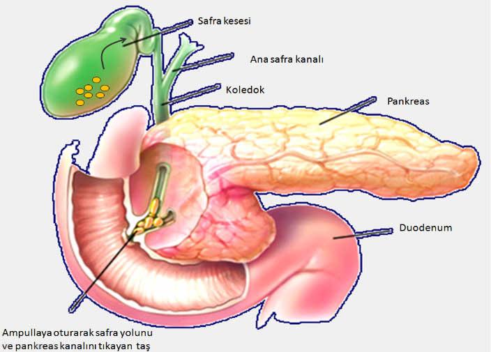 Pankreatik Nedir? 10 Temel Gerçekle Öğrenin