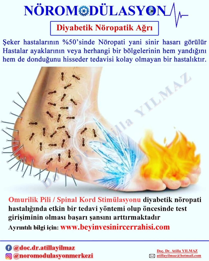 Nöropati Nedir? İşte Bilmeniz Gereken 10 Temel Nokta