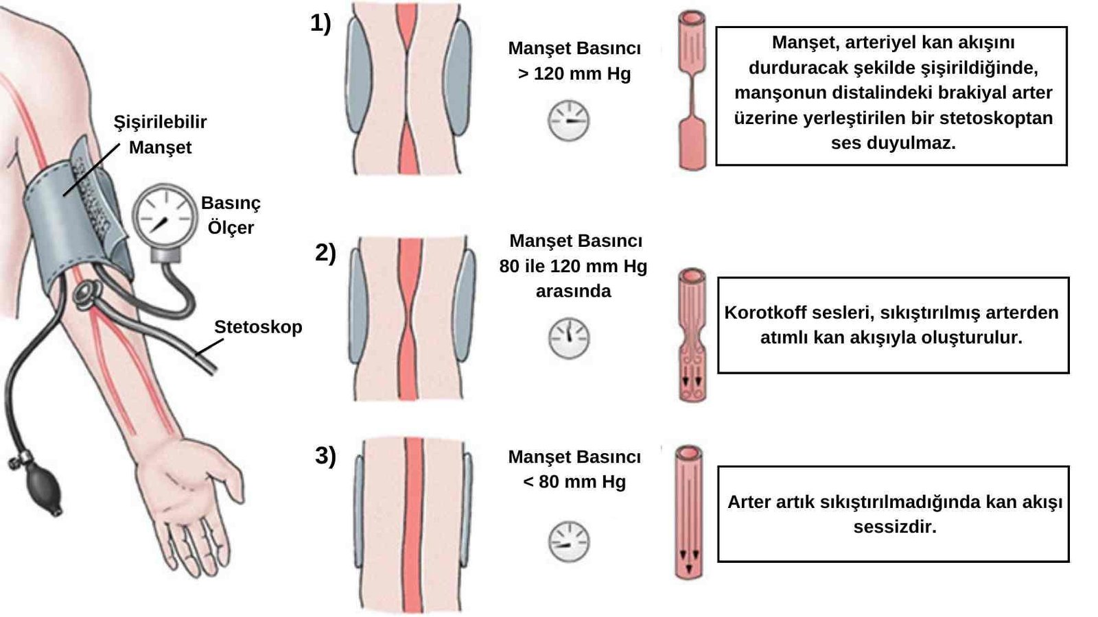 3)‌ Sistolik tansiyon, kalbin kasılması sırasında ölçülen basıncı⁢ gösterir