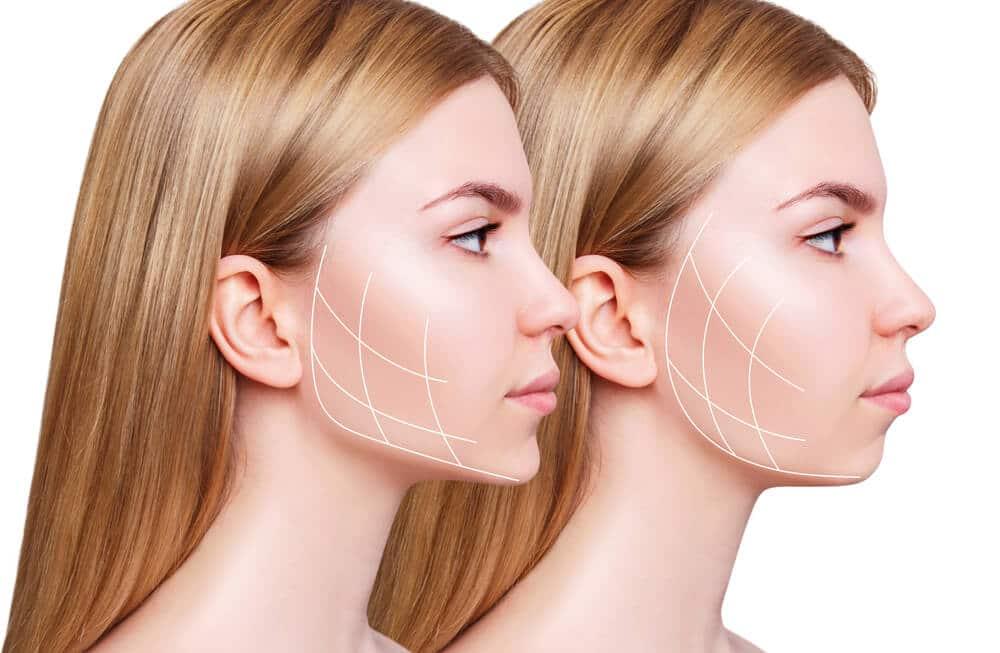 Jawline Nedir? 10 Temel Bilgi ile Yüz Yapınızı Tanıyın