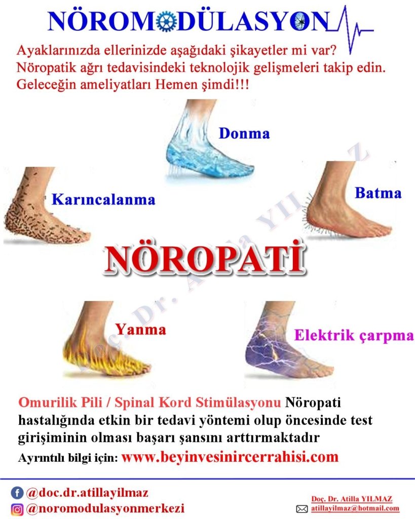 Nöropati Nedir? 10 Önemli Bilgi ile Bilinçlenin