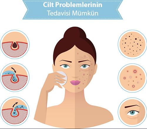 2) Cilt problemlerine karşı ​etkili bir ⁢tedavi seçeneğidir