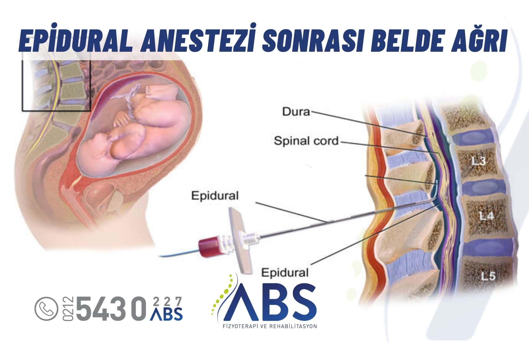 5) Epidural anestezi‍ gibi ağrı yönetimi seçenekleri ⁢doğumhanelerde ⁤mevcuttur