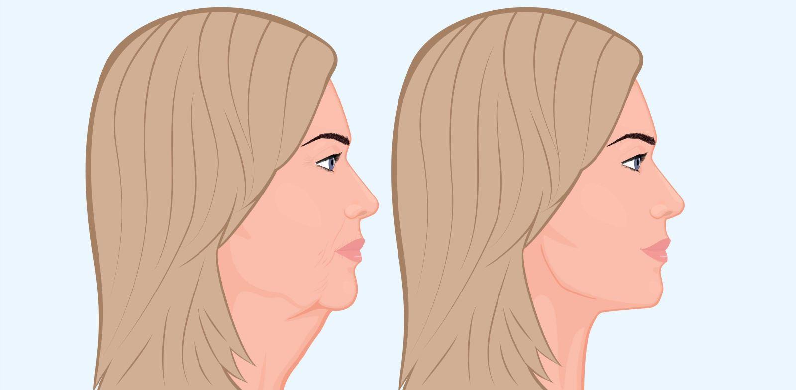 1) Jawline‍ Nedir ve Önemi nedir?