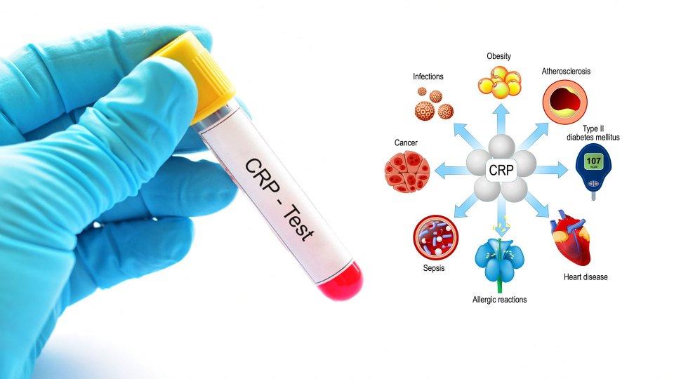 1) CRP Nedir ve Ne ‌Anlama‍ Gelir?