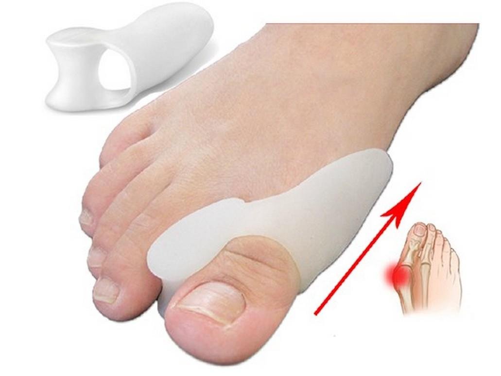 3) Hallux valgus nedenleri:⁢ Genetik, ayakkabı ve diğer faktörler