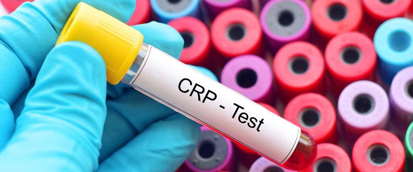 2) C-Reaktif Protein ve Vücut ​Tepkisi