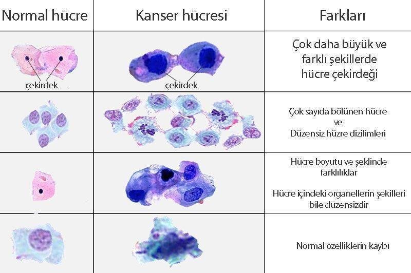 4) Kanser türleri⁢ ile CA‍ 15-3​ arasındaki ​ilişki