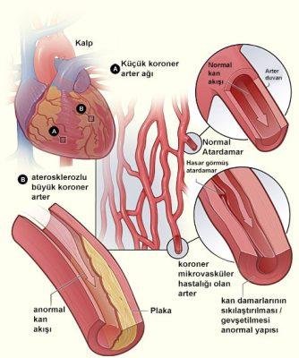 10) Kan basıncının düzenli takibi, sağlık sorunlarının önlenmesi açısından gereklidir