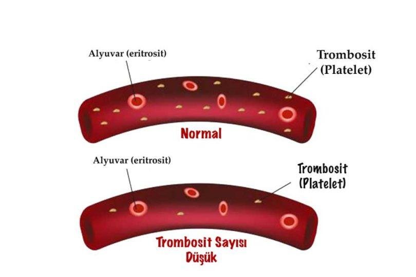 4) Normal PLT Değer⁢ Aralıkları